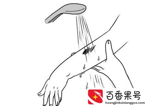 不小心擦破皮，怎么处理伤口才正确？4个妙招让你愈合快疤痕少！