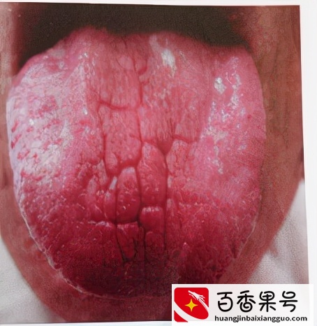 总爱生病，抵抗力差，中医教你3个方法，有效增强抵抗力