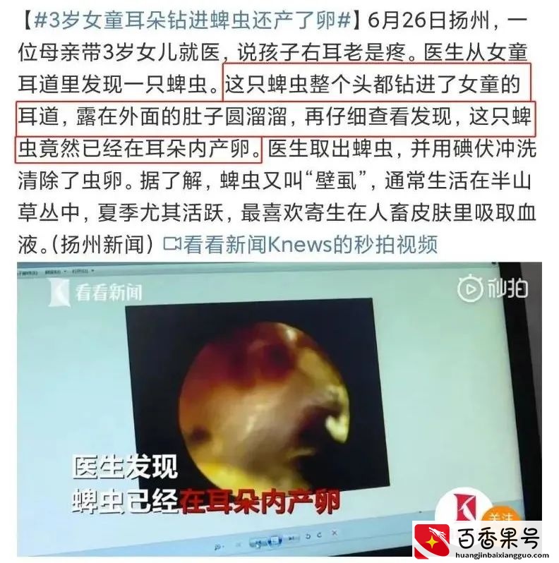 孩子被蜱（pí ）虫咬伤不疼不痒，如何一招尽早识破