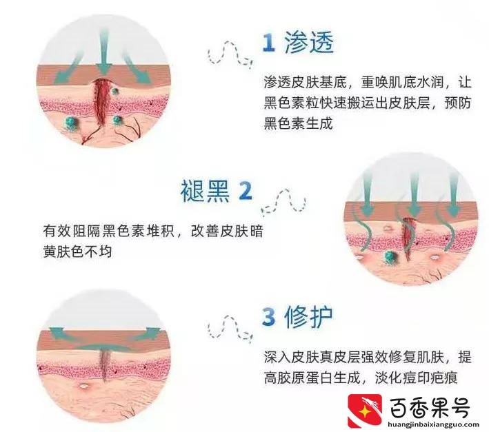 去医院皮肤科看痘痘真的靠谱吗？