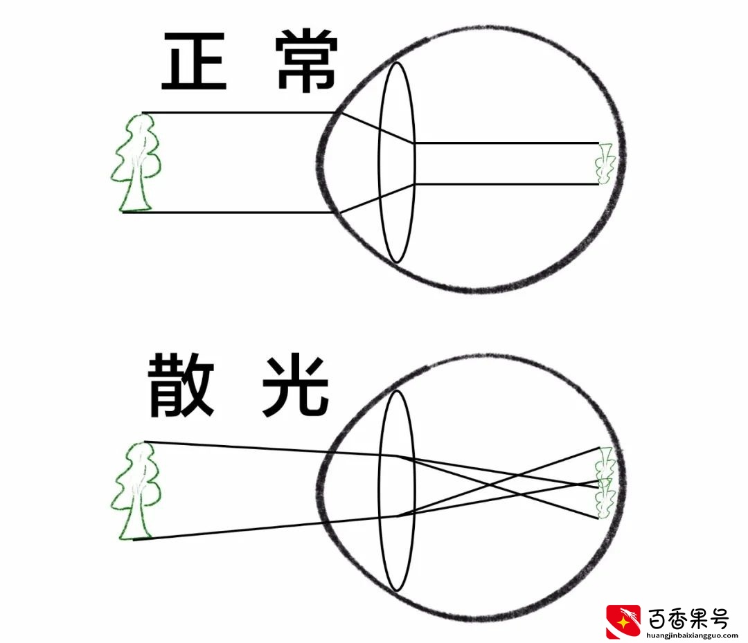 5秒自测 | 看不清这张图，你可能有散光
