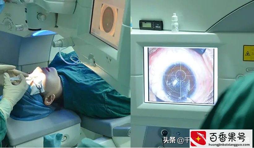 干货大盘点：近视以后怎么办？总有一种方法适合你