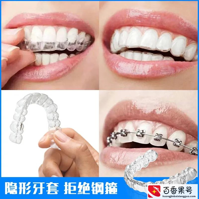 为儿子整牙花了四万多，为此我放弃了二胎，大家认为值得吗？