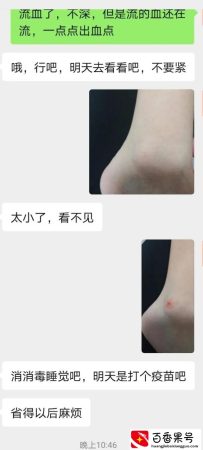 明天要不要给孩子打狂犬疫苗