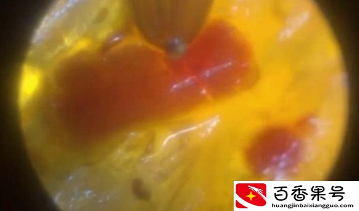 卫龙辣条真的“脏”吗？显微镜下放大400倍，网友：送我也不吃
