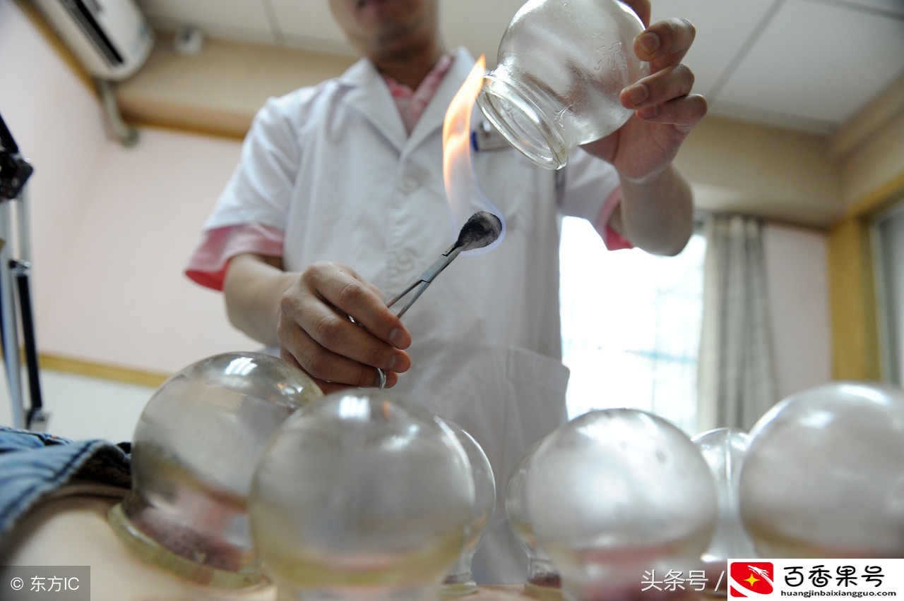 拔火罐有哪些好处和坏处？先了解清楚再去拔，并非每个人都适合！