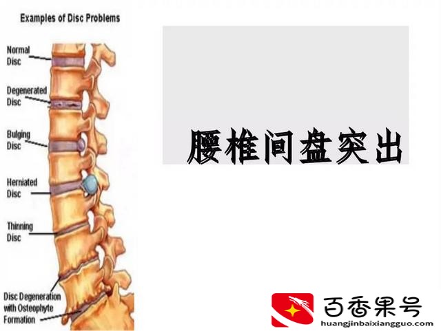我坚持爬行锻炼二个月了