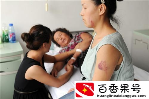 五岁孩子楼上蹦跳惹楼下不满 两家邻居动了手