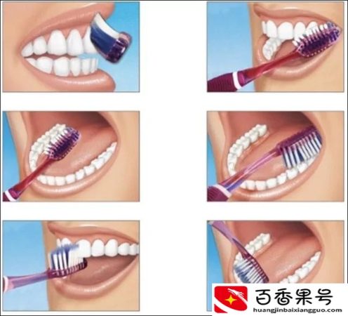 医生为什么建议不用电动牙刷