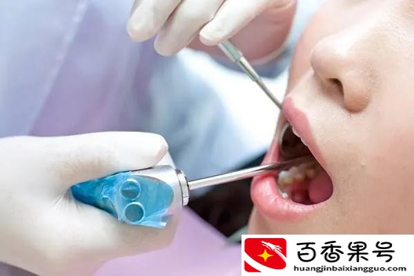 一个故事：洗牙是我做过最后悔的事