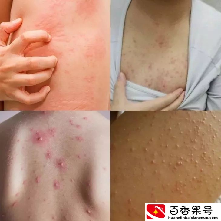 日本发明了“变态”搓澡巾！一搓一层泥，泥灰就哗啦啦往下掉