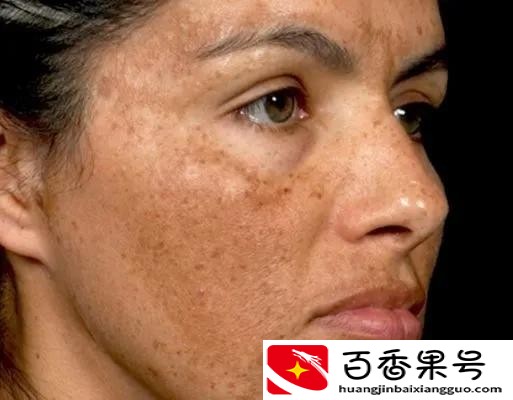 龙血膏贵妇膏真的那么神奇吗