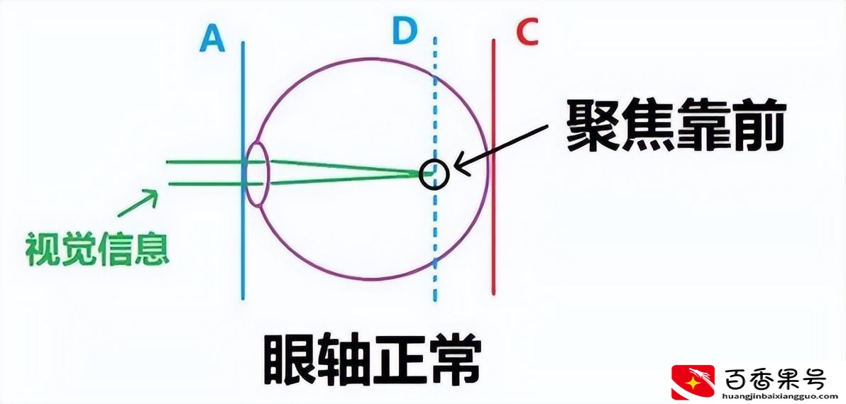 为什么不建议买激光电视