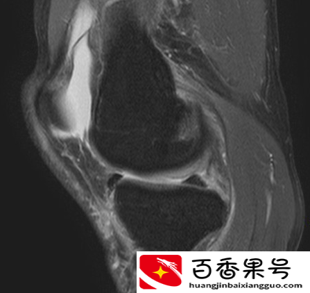做磁共振检查需要多少钱