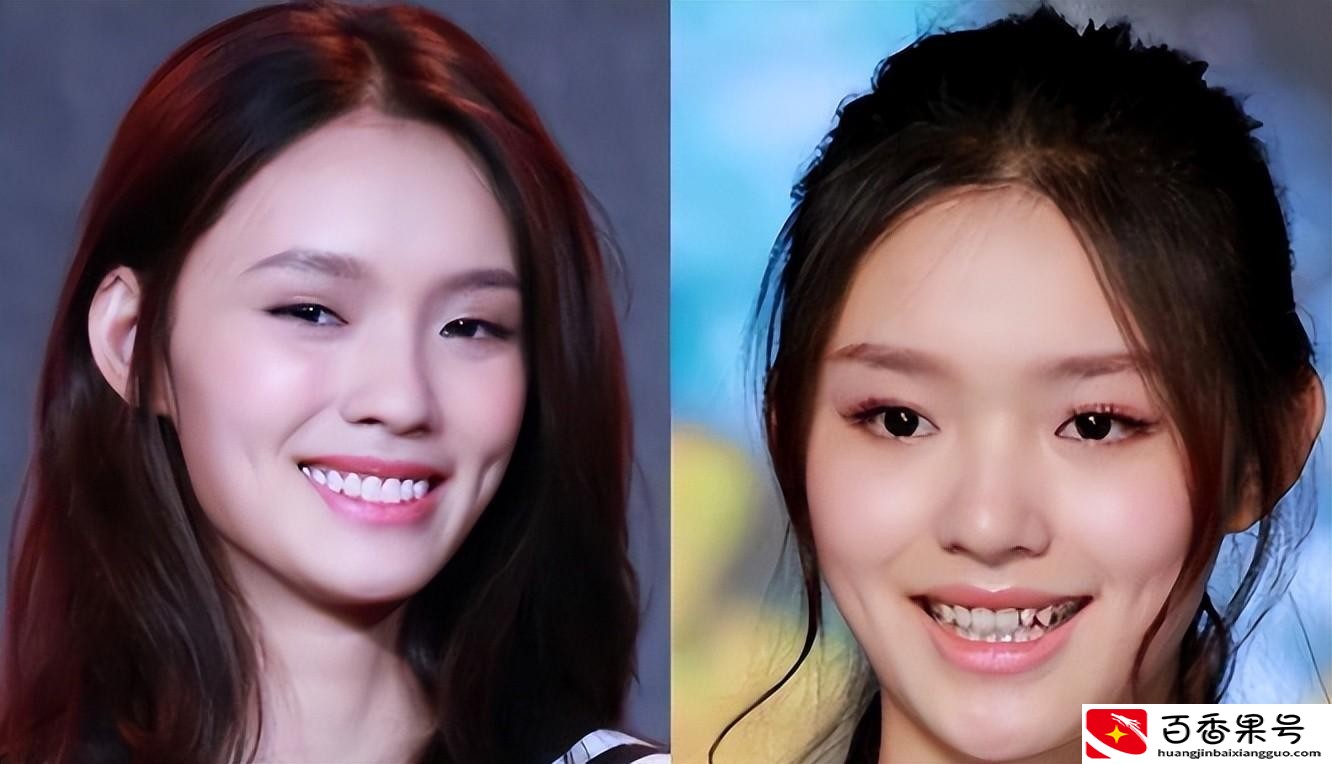假发假臀假肌肉，大半娱乐圈“从头假到脚”，还有什么是真的-图4