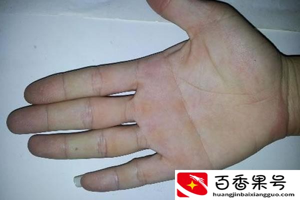 历史上拥有双断掌的人