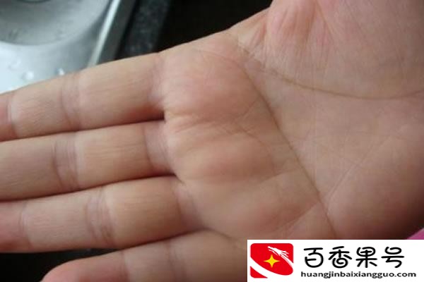 历史上拥有双断掌的人