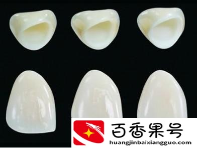 良心牙医不建议做全瓷牙