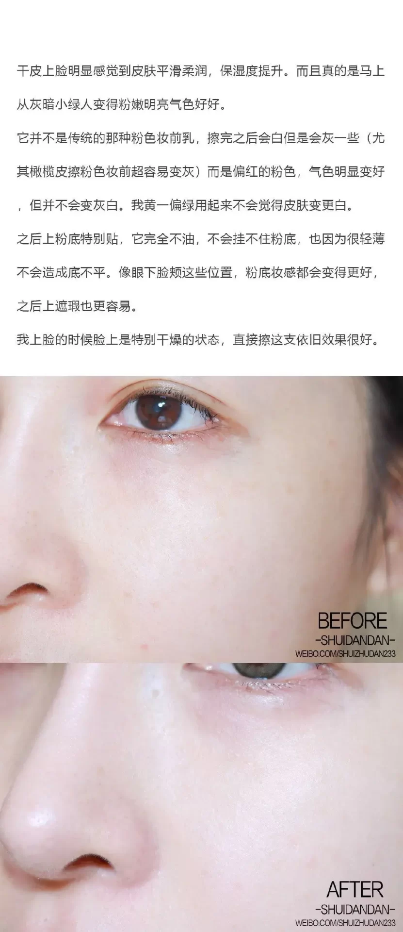 橄榄皮是什么皮肤