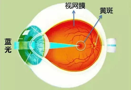 蓝光对眼睛的伤害都有哪些