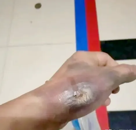 被电了一下立马甩开了