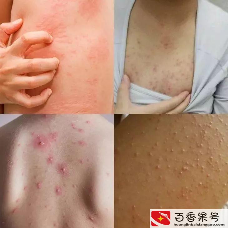 搓澡巾是哪个国家发明的产品
