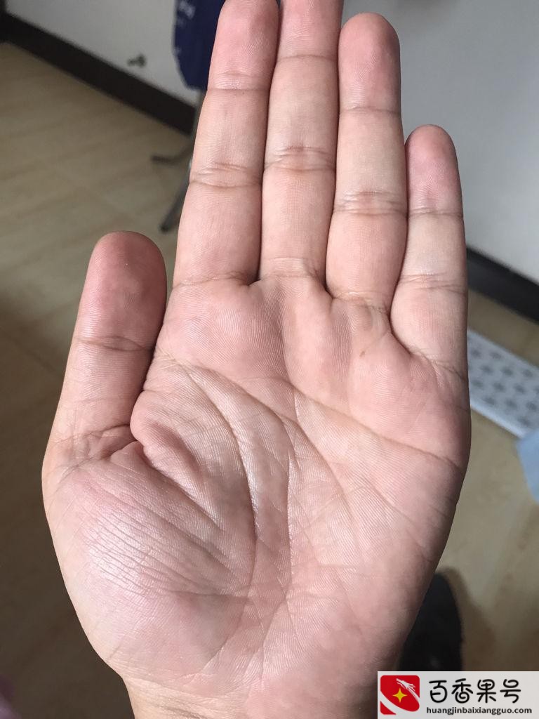 掌纹的三条线代表什么